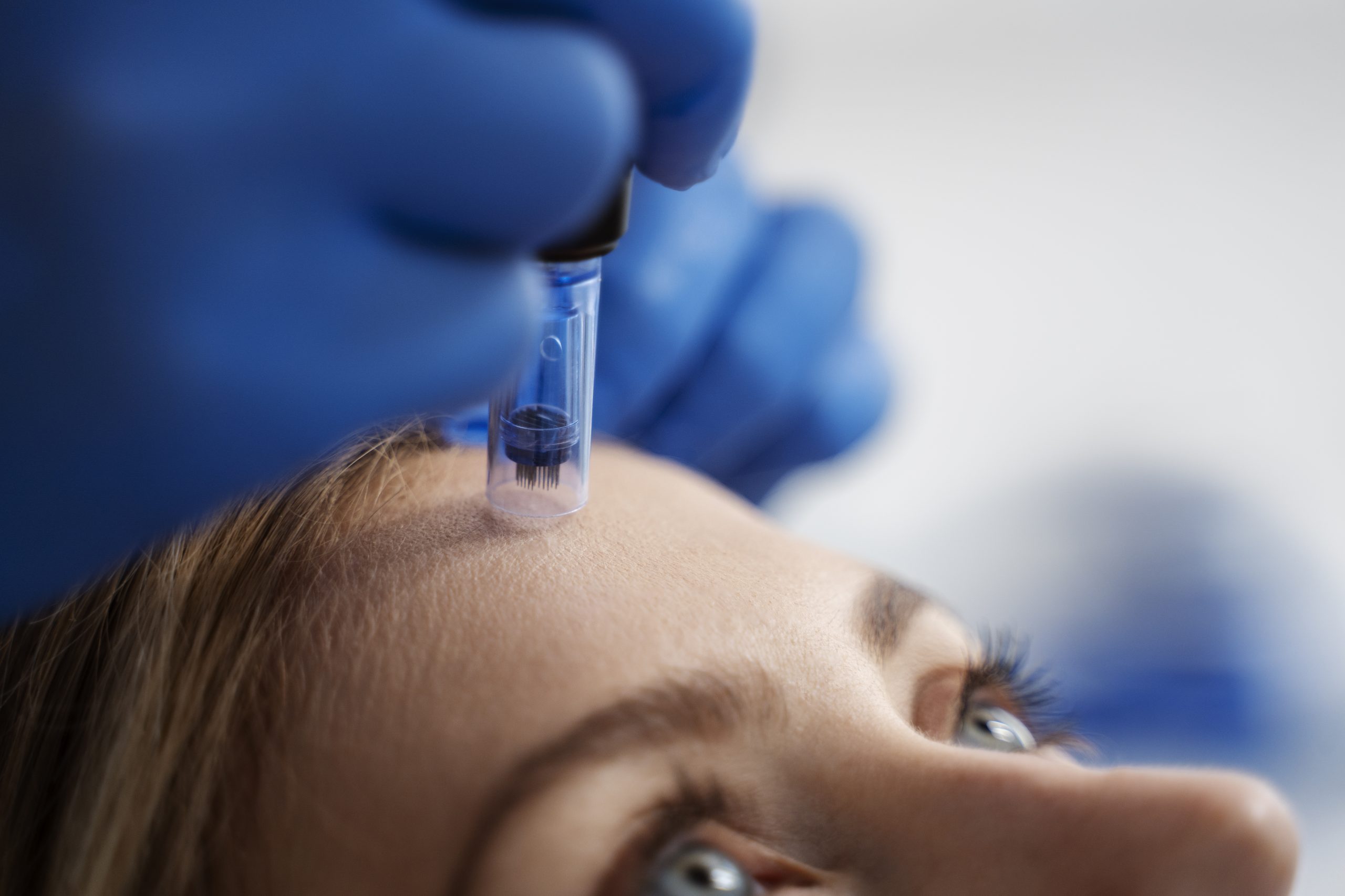 Understanding Botulinum Toxin Type A: How It Works and What It Does for Your Skin